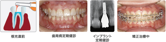 常に使用