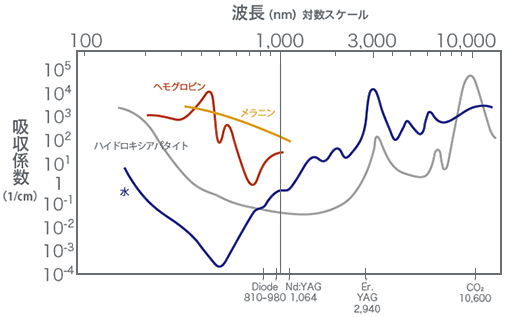 レーザーの波長